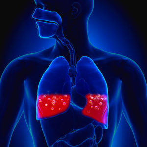Pulmonary Embolism as Panic Attacks